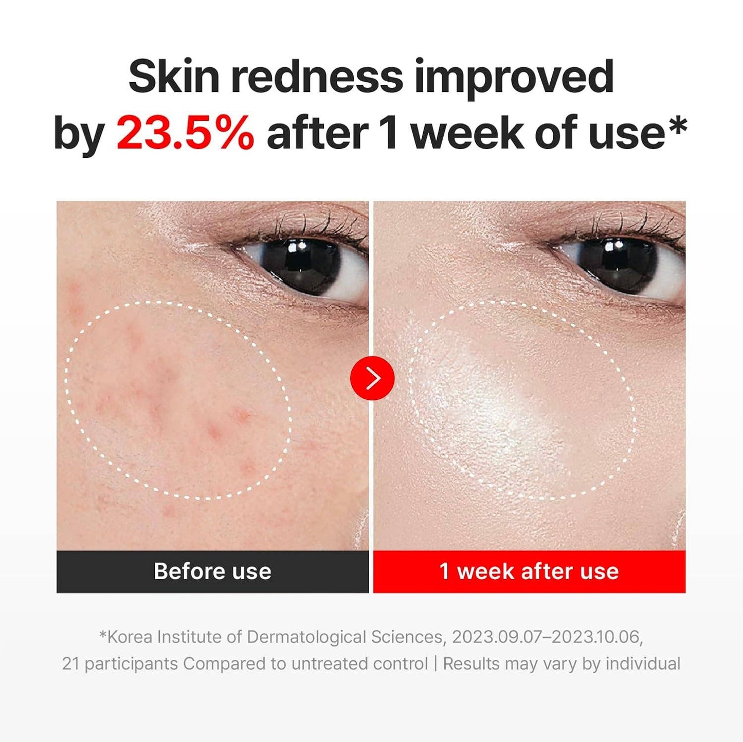 Centellian 24 Madeca Cream Time Reverse, Anti-Aging Korean Cream with TECA & Collagen