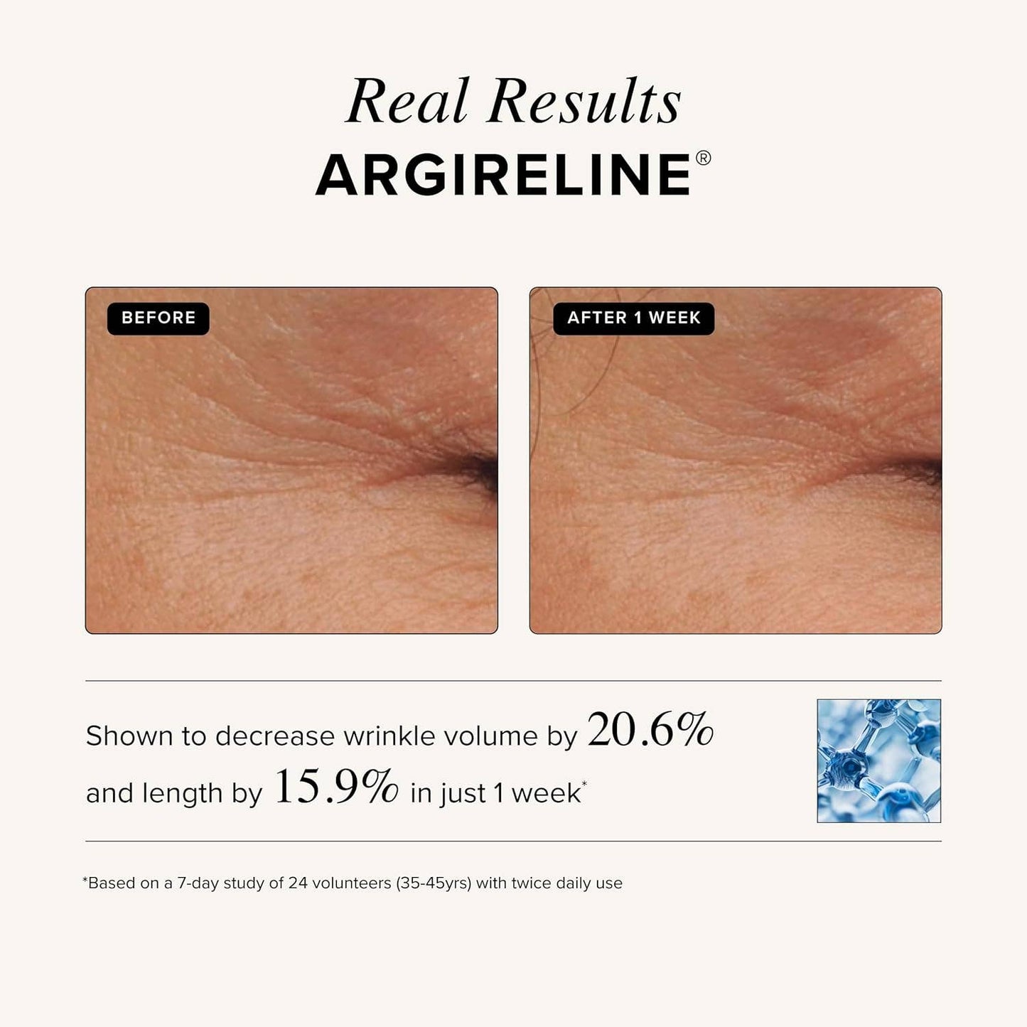 Matrixyl 3000 + Argireline Serum: 1oz