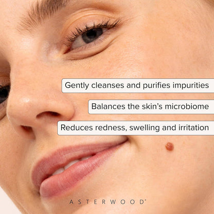 Hypochlorous Acid Spray