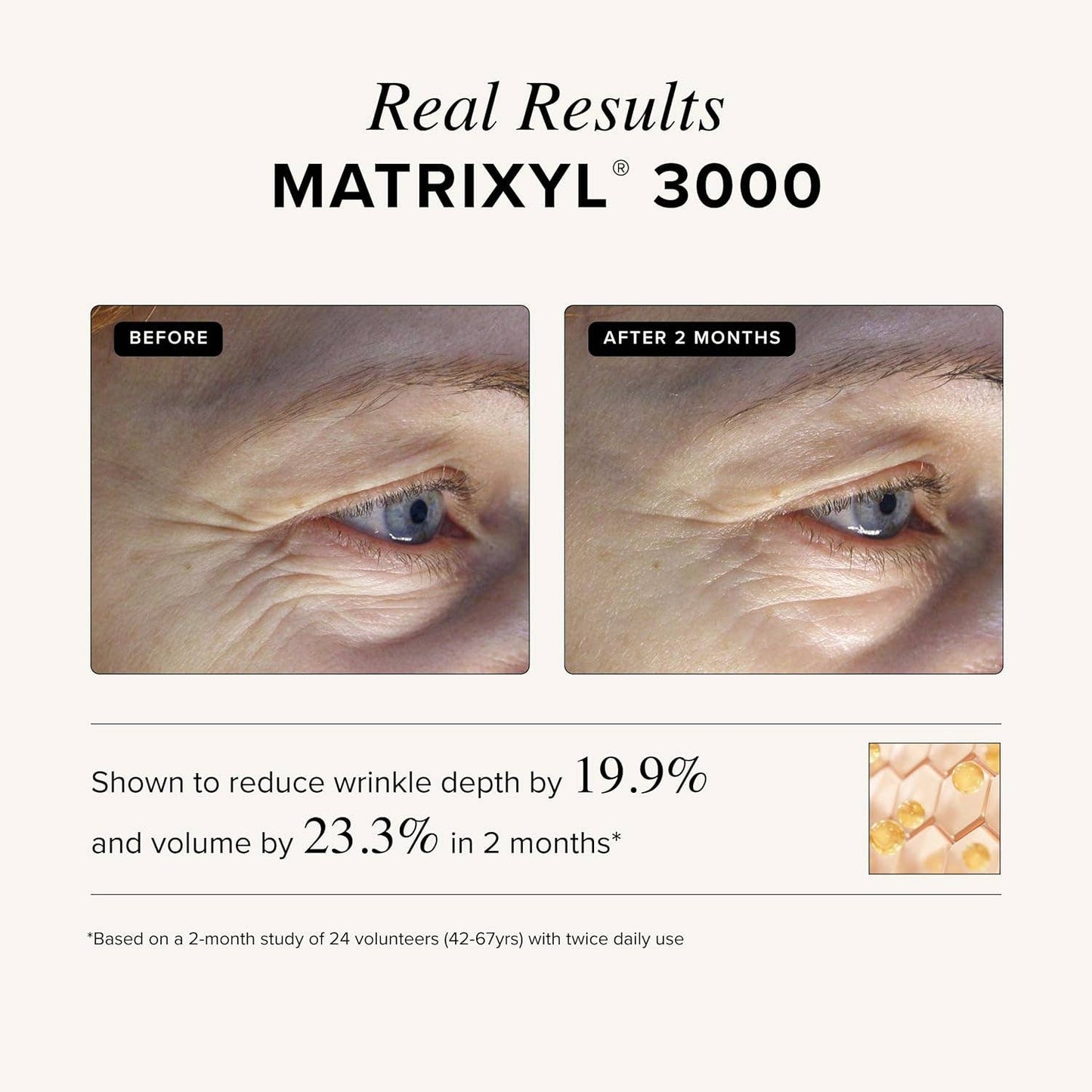 Matrixyl 3000 + Argireline Serum: 1oz