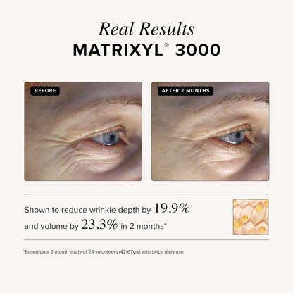 Matrixyl 3000 + Argireline Serum: 1oz